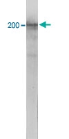MAB5387 - Neurofilament H (200 kD)