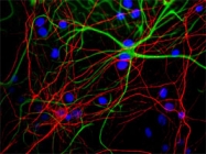MAB5387 - Neurofilament H (200 kD)