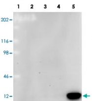 MAB5428 - Beta-2-microglobulin