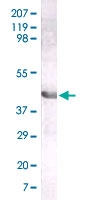MAB5527 - LIPA