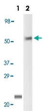 MAB5528 - LCK