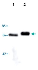 MAB5529 - Lipoprotein lipase