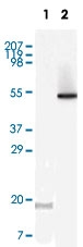MAB5531 - LYN