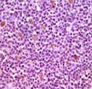 MAB5535 - MCL1