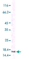 MAB5536 - MCP1 / CCL2