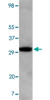 MAB5537 - ASPSCR1