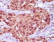 MAB5538 - MSH2