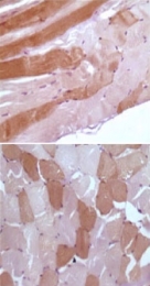 MAB5539 - Myoglobin
