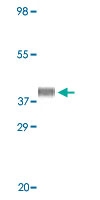 MAB5539 - Myoglobin
