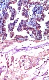 MAB5551 - TRIM5 / RNF88