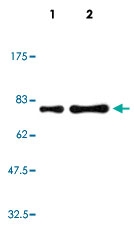 MAB5555 - Human IgM