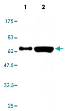 MAB5556 - Human IgA