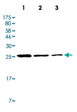 MAB5558 - HSPB2