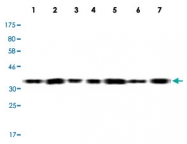 MAB5561 - PPP1R3A
