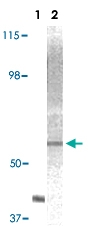 MAB5563 - AKT2 / PKB beta