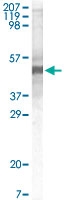 MAB5564 - Apolipoprotein A V / ApoA5