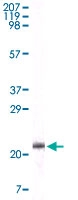 MAB5564 - Apolipoprotein A V / ApoA5