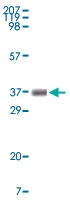 MAB5567 - Bcl-10