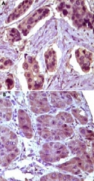 MAB5567 - Bcl-10