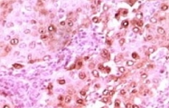 MAB5570 - S100A6 / Calcyclin