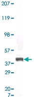MAB5570 - S100A6 / Calcyclin