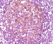 MAB5572 - CD14