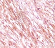 MAB5577 - CD117 / c-kit