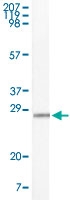 MAB5577 - CD117 / c-kit