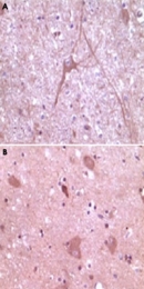 MAB5579 - Dynamin-2