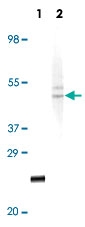 MAB5581 - Fibulin-5