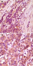 MAB5581 - Fibulin-5