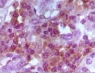 MAB5583 - FOXP3