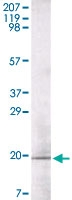 MAB5584 - Glucagon