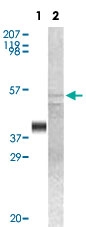 MAB5585 - GSK3 alpha