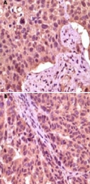 MAB5585 - GSK3 alpha