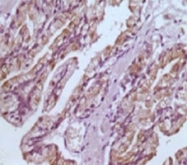 MAB5586 - GSTP1 / GST3