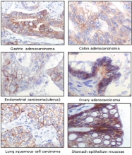 MAB5588 - CD221 / IGF1R