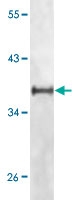 MAB5588 - CD221 / IGF1R