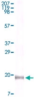 MAB5590 - Interleukin-16 / IL16