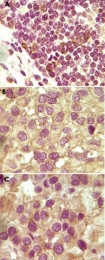 MAB5591 - Inhibin alpha / INHA