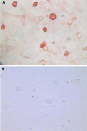 MAB5592 - Herpes Virus Type 8 / HHV8