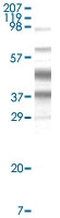 MAB5592 - Herpes Virus Type 8 / HHV8