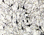 MAB5595 - CD271 / NGFR