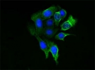 MAB5629 - Cytokeratin 8