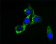 MAB5630 - Cytokeratin 18