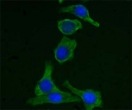 MAB5631 - Cytokeratin 19