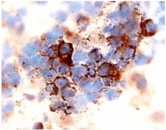 MO15022-100 - CD184 / CXCR4