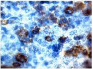 MO15088-100 - CD191 / CCR1