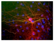 MO22103-100 - Neurofilament H (200 kD)