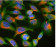 MO22131-100 - Ubiquilin-2 (UBQLN2)